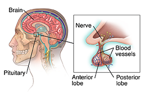 Side view of head and neck with cross section of brain showing pituitary gland. Inset shows closeup of pituitary.